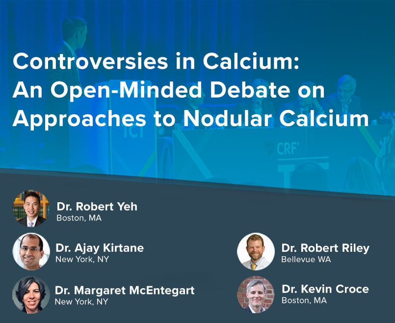 an-open-minded-debate-on-approaches-to-nodular-calcium